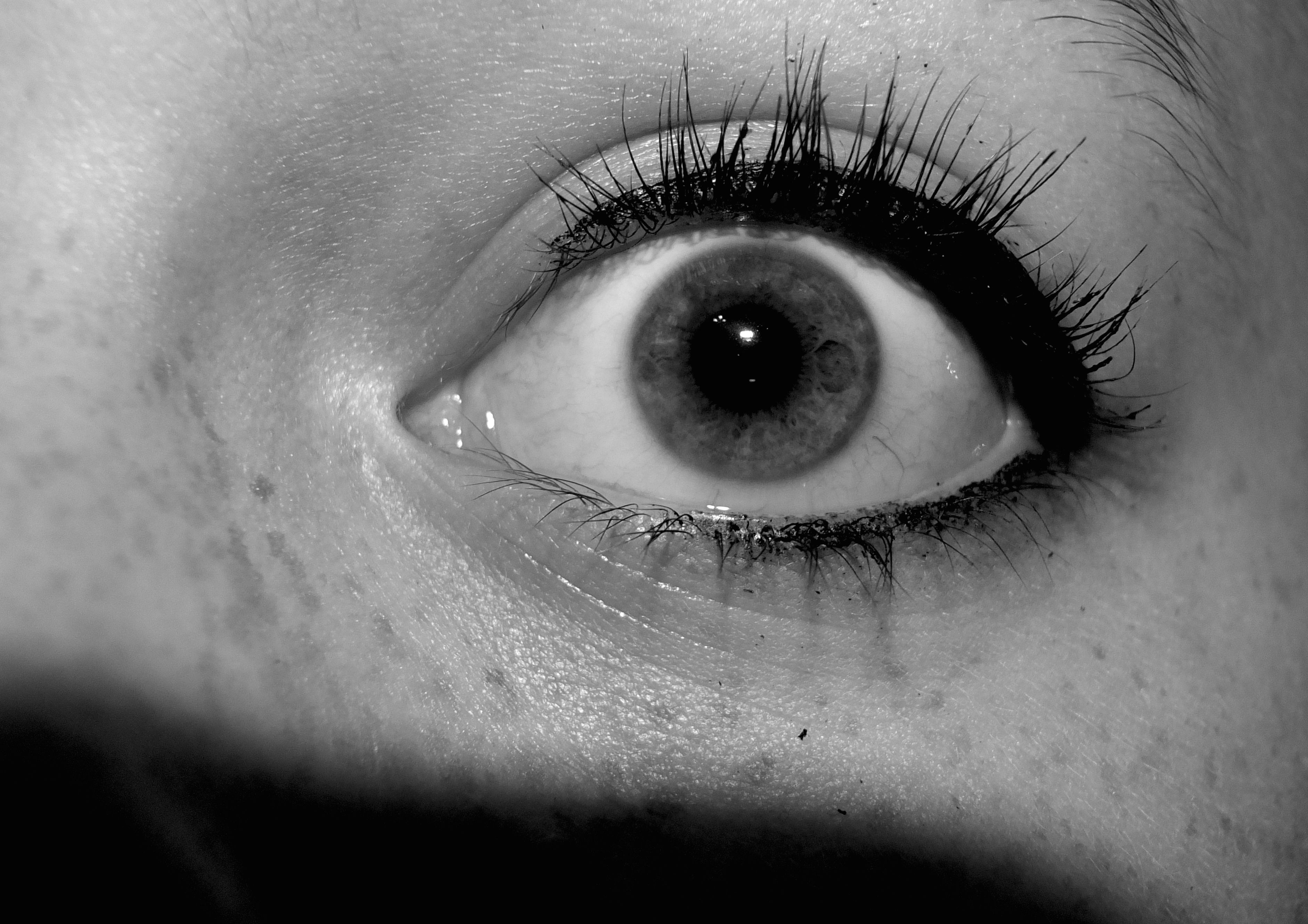 Close-up black and white photo of an eye with pale skin and freckles | The iris is dark and large with a tiny light